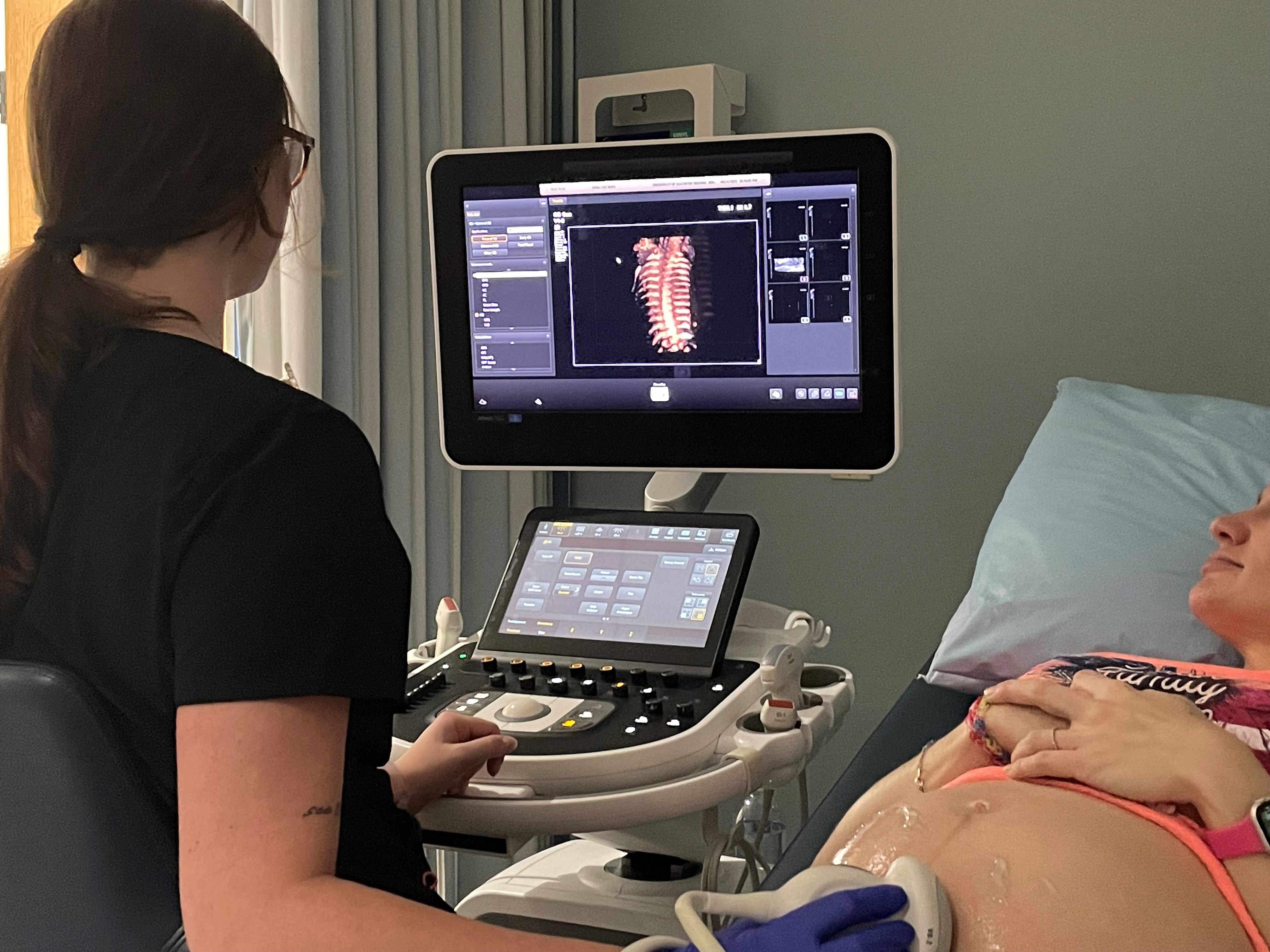 USI DMS Program offers free pregnancy ultrasounds   - News article image